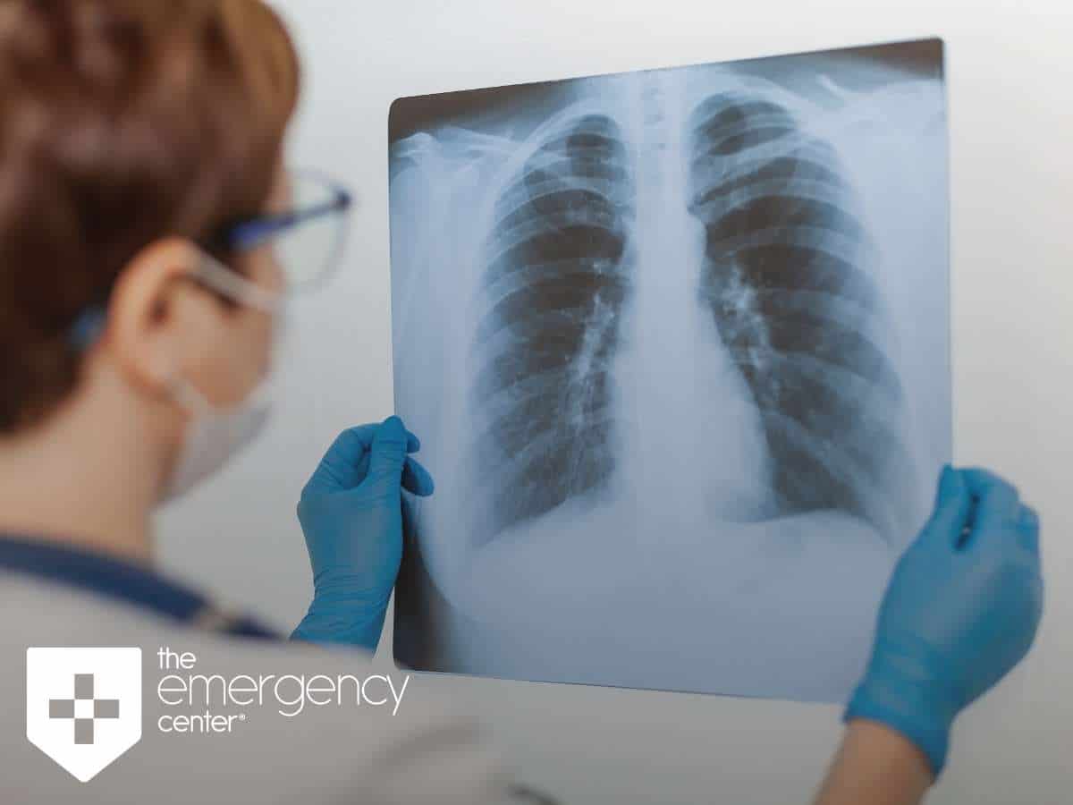 Physician Inspecting Lung X-Ray In San Antonio, TX
